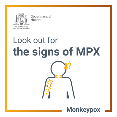 Banner tile: Monkeypox cases are in Western Australia