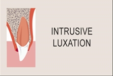 Intrusive luxation