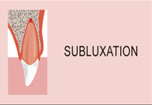 Sublaxation